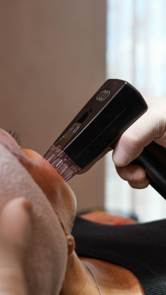 tratamento Morpheus 8